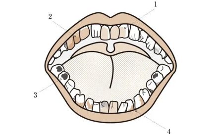 50代、年々劣化する「歯の見た目」印象を悪くする4つの要素とは？