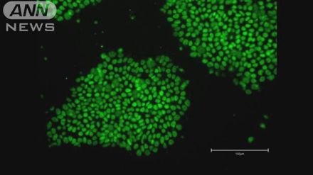 大手化粧品メーカー　iPS細胞使った美容商品開発へ