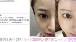 愛沢えみり、キャバ嬢時代と現在のスッピン比較写真＆美容整形の施術内容を公開「時代に合わせてアプデされていてさすが」と話題に