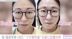 エヴァ芸人・桜 稲垣早希（40）、移住先のタイで“プチ整形” 施術後の姿に「可愛すぎて3度見した」の声