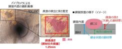 NTT、機械学習で画像から鋼材の腐食を推定