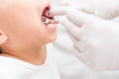 「学校歯科健診」で子どもの歯並び・噛み合わせを指摘されたら歯列矯正すべき？ 受診のタイミングを歯科医が解説