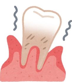 歯を失う原因第一位の「歯周病」防ぐには　ロッテが発信