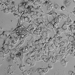 ヒトiPS細胞から精子卵子の元を大量作製する手法開発　京都大、４カ月で100億倍超に