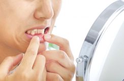 歯を白くする「医療ホワイトニング」のメリットとデメリット…世代を超えて人気