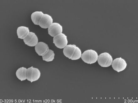 劇症型溶連菌の感染者急増　過去最多ペース、致死率3割　識者「高齢者は警戒を」