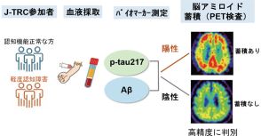 アルツハイマー病、原因タンパクの血液検査で発症予測 東大など、早期診断に期待