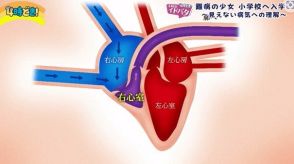 「できることは全力で頑張る」見えない病気と向き合う少女が小学校までの1.5キロを諦めずに歩く理由は