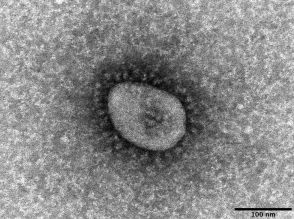 米、コロナ後遺症に定義　「症状3カ月」共通化図る