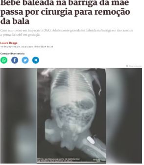 《ブラジル》母親の体内で赤ちゃん被弾＝帝王切開で緊急出産、手術
