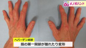 “手のしびれや指の痛み”実は「メノポハンド」かも?　更年期女性は特に注意　発症抑える3つのストレッチ法