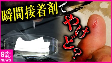 『瞬間接着剤』やけどに注意　“つけ爪用の接着剤”で子供がやけどする事故も　衣服などに付着した際は大量の水をかけて