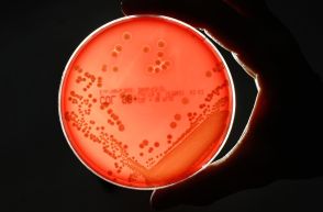 今や菌に薬が効かない「ポスト抗生物質」時代に突入と医師が警鐘、世界で年500万人が死亡