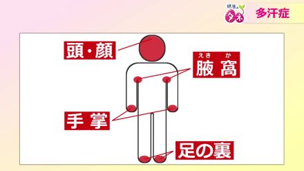 体質と諦めないで!手汗や脇汗で日常生活に支障…それは「原発性局所多汗症」かも　適切な診断と治療でQOL向上を