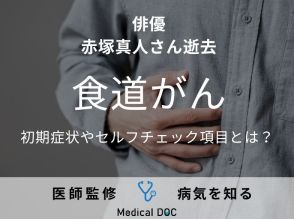 俳優・赤塚真人さん逝去 「食道がん」の初期症状やセルフチェック項目とは?