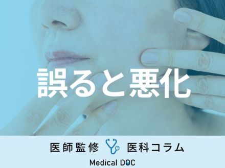 シミは部位ごとに原因が違うって本当？ それぞれのケア方法を医師に聞く