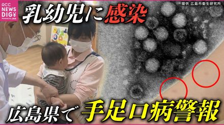 「手足口病」感染拡大　症状や感染経路 予防方法は　小児科医「まずは規則正しい生活を」