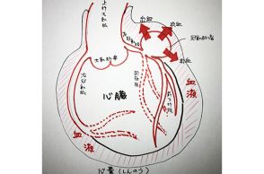 同時に併発?「冠動脈瘤」と「心タンポナーデ」とは?～『ブラックペアン』監修ドクターが解説 vol.14～