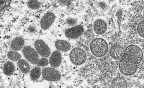エムポックス（サル痘）との戦いはまだ続いている…コンゴ民主共和国で新型ウイルスによる流行が発生（海外）