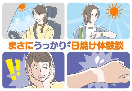 うっかり日焼けしがちなパーツ「首の後ろ」、「手の甲」、1位は？「自転車で手の甲が真っ黒...」「サンダルを脱いだら見事にサンダルの形に！」