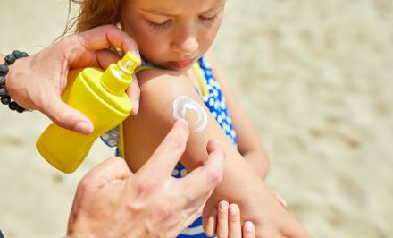 子どもの日焼け、どこまで気にすればいい？　日焼け止めは毎日塗るべき？　専門医に聞く