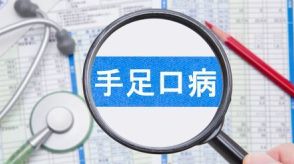 【手足口病】定点あたりの感染者数は14週連続で増加、この時期の感染者数としては過去10年で最多　感染が増えている理由として指摘される「2つの可能性」