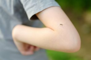 子どもの虫刺され、大人よりはれるのはなぜ？　専門医に聞く、仕組みと対処法