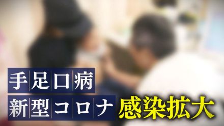 感染拡大傾向の“新型コロナウイルス”と“手足口病”…症状収まっても油断禁物「ウイルス長く体内に」対策徹底を