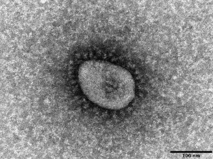 沖縄コロナ、ピークを越えか　2週連続で減、インフルは増に　新規入院は依然100人超え