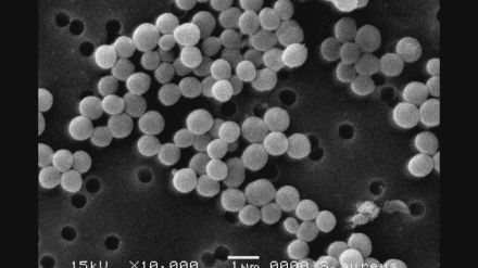 【黄色ブドウ球菌】常に手指・顔などにいる恐れ “家庭でも注意を” 土用の丑の日のうなぎで集団食中毒