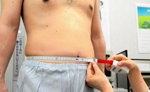 日本でも増加の脂肪肝からの肝がん　リスク見分ける新指標を発見