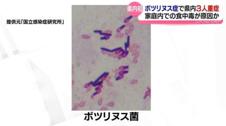 富山県内で初めて感染確認　ボツリヌス症で３人重症