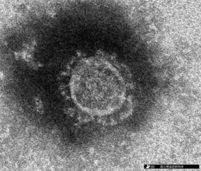新型コロナ、最新の変異株が持つ特徴は　今後の感染、どう対応?