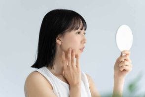 ニキビと吹き出物の違いは何？　できてしまう原因で勘違いしがちなことを医師が解説