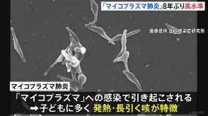 「マイコプラズマ肺炎」約8年ぶりの高水準で広がる　全国の患者数5週連続増　長引く咳が特徴