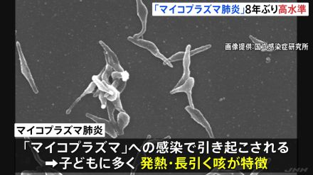 「マイコプラズマ肺炎」約8年ぶりの高水準で広がる　全国の患者数5週連続増　長引く咳が特徴