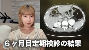 2年の余命宣告を受けたYouTuber、抗がん剤終了後の定期検診結果を報告　以前は「再発リスク高い」発言も