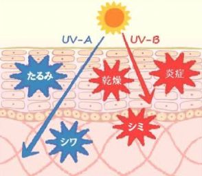 【日焼け後のレスキューケア】医師がアドバイス！紫外線ダメージは溜め込まない！