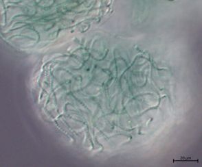 「雨の香り」発生させる微生物→「香水の原料」で活用へ…韓国のチームが研究