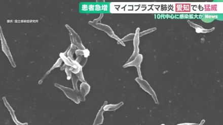 猛威を振るう「マイコプラズマ肺炎」　検査しても結果がすぐに出ないことも　長い潜伏期間