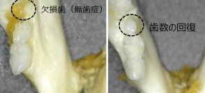 「歯生え薬」の治験開始へ　30年の実用化目指す　北野病院など