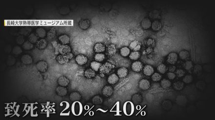 蚊が媒介「日本脳炎ウイルス」 発症後の致死率20～40％ 涼しくなり蚊の活動も活発になると要注意