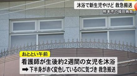 福田病院で新生児が沐浴中にやけど　別の病院に救急搬送【熊本】