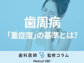 歯周病に「重症度」があるのをご存じですか? 各ステージの「外科治療の要否」や「判断基準」も知りたい