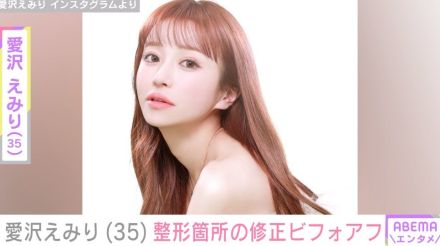 元歌舞伎町No.1キャバ嬢・愛沢えみり（35）、整形箇所の修正を報告＆ビフォアフ公開 「土台は思い切って課金する」