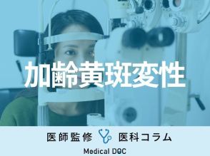 加齢黄斑変性を調べる眼底検査ってどういう検査？ ほかにどんな検査で調べるの？