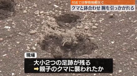 道路でクマと鉢合わせ…男性襲われケガ　長野・小諸市