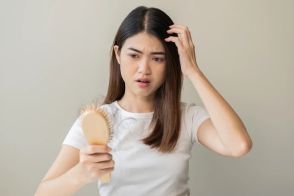 医師が回答！「そもそも薄毛の定義ってなんですか？ 」【30代女性の薄毛問題】