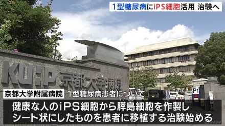 京都大学病院が“糖尿病治験”へ iPS細胞から膵島細胞を作製 「インスリン注射不要」への期待