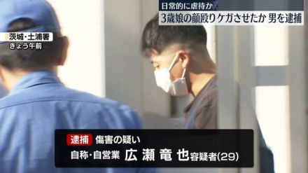 3歳娘の顔を殴りケガさせたか　男を逮捕